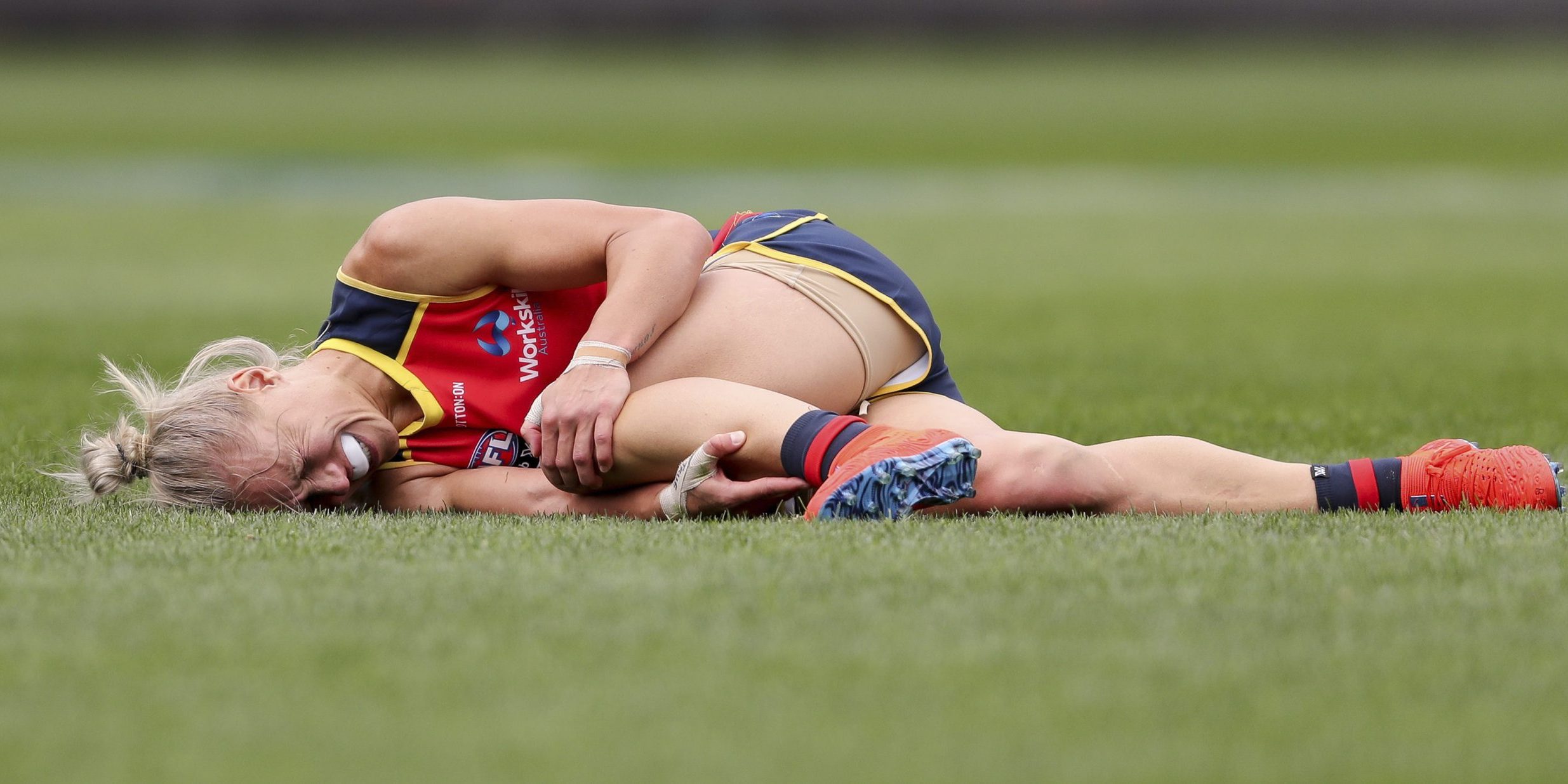 ACL Injury Prevalence in Females