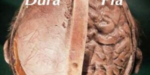 Read more about the article Pia Mater