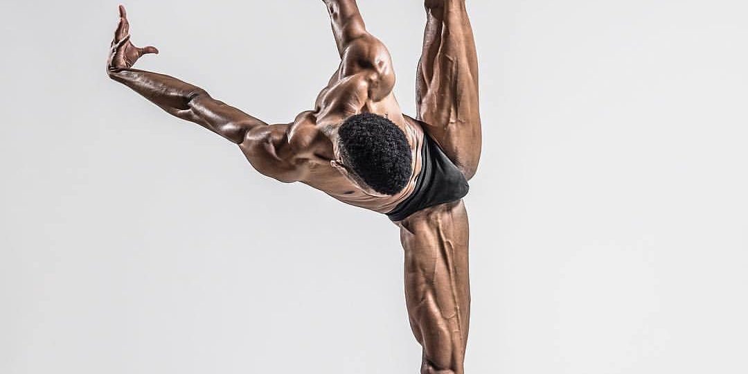 Hypermobility Part II