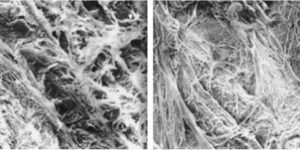 Read more about the article Fascia and Stasis Part I